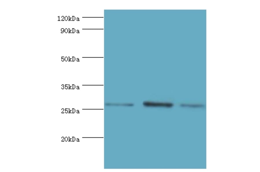 AZU1 Polyclonal Antibody from Signalway Antibody (42077) - Antibodies.com