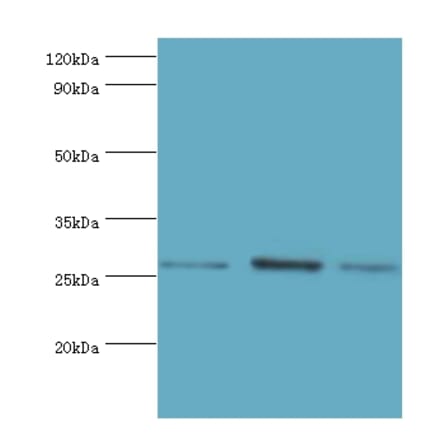 AZU1 Polyclonal Antibody from Signalway Antibody (42077) - Antibodies.com