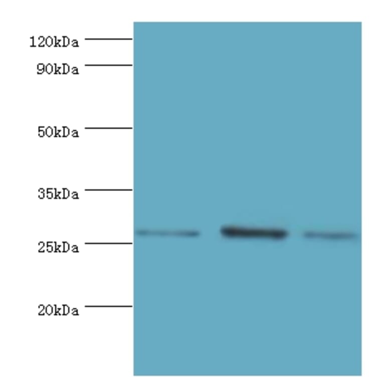 AZU1 Polyclonal Antibody from Signalway Antibody (42077) - Antibodies.com