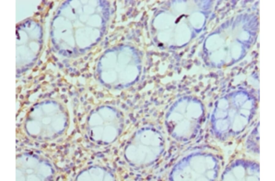 Immunohistochemistry - AZU1 Polyclonal Antibody from Signalway Antibody (42077) - Antibodies.com