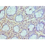 Immunohistochemistry - AZU1 Polyclonal Antibody from Signalway Antibody (42077) - Antibodies.com