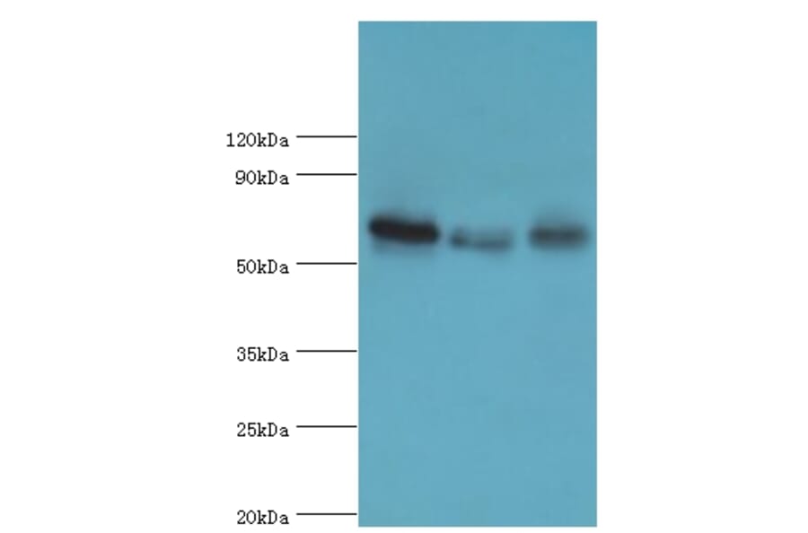 GBP1 Polyclonal Antibody from Signalway Antibody (42176) - Antibodies.com