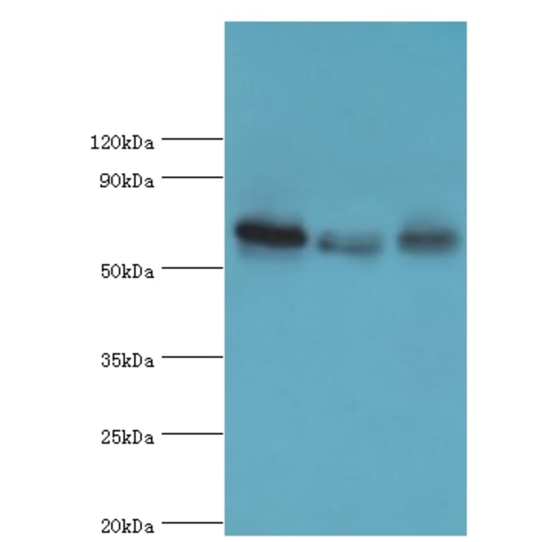 GBP1 Polyclonal Antibody from Signalway Antibody (42176) - Antibodies.com