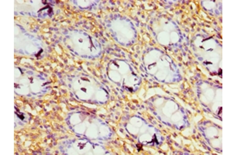 Immunohistochemistry - GBP1 Polyclonal Antibody from Signalway Antibody (42176) - Antibodies.com