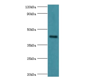 GJC1 Polyclonal Antibody from Signalway Antibody (42181) - Antibodies.com