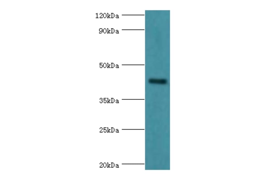 GJC1 Polyclonal Antibody from Signalway Antibody (42181) - Antibodies.com