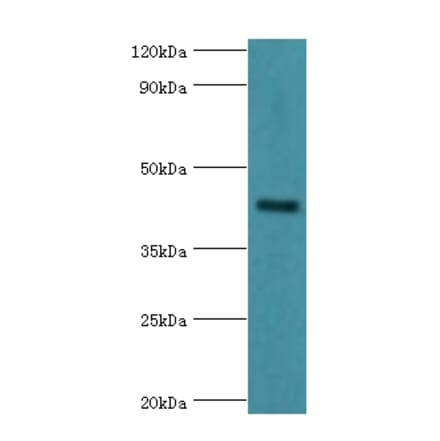 GJC1 Polyclonal Antibody from Signalway Antibody (42181) - Antibodies.com