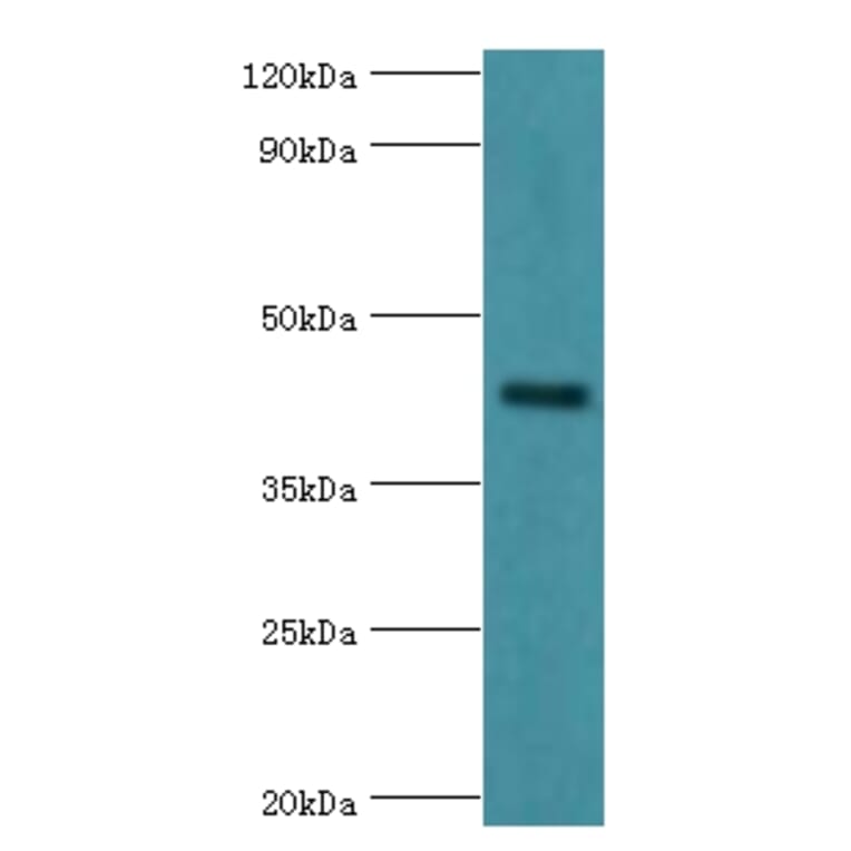 GJC1 Polyclonal Antibody from Signalway Antibody (42181) - Antibodies.com