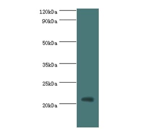H1F0 Polyclonal Antibody from Signalway Antibody (42197) - Antibodies.com