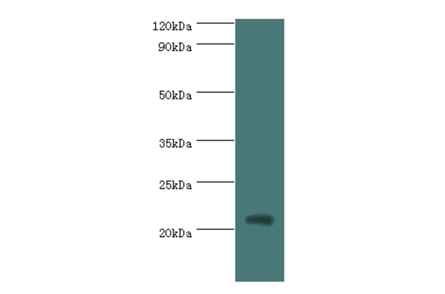 H1F0 Polyclonal Antibody from Signalway Antibody (42197) - Antibodies.com