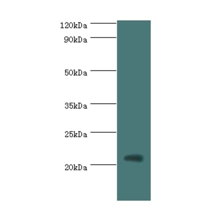 H1F0 Polyclonal Antibody from Signalway Antibody (42197) - Antibodies.com