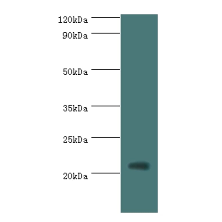 H1F0 Polyclonal Antibody from Signalway Antibody (42197) - Antibodies.com