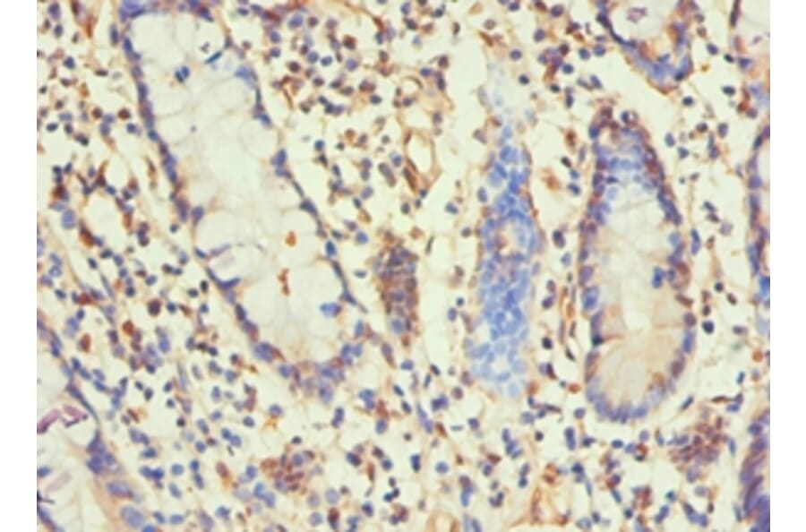 Immunohistochemistry - H1F0 Polyclonal Antibody from Signalway Antibody (42197) - Antibodies.com