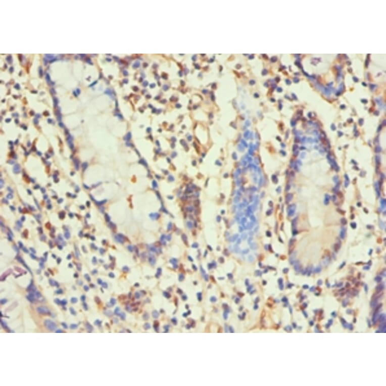 Immunohistochemistry - H1F0 Polyclonal Antibody from Signalway Antibody (42197) - Antibodies.com