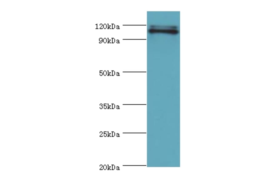 HIP1 Polyclonal Antibody from Signalway Antibody (42205) - Antibodies.com