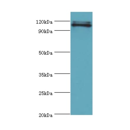 HIP1 Polyclonal Antibody from Signalway Antibody (42205) - Antibodies.com