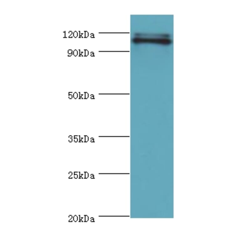 HIP1 Polyclonal Antibody from Signalway Antibody (42205) - Antibodies.com