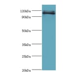 HIP1 Polyclonal Antibody from Signalway Antibody (42205) - Antibodies.com