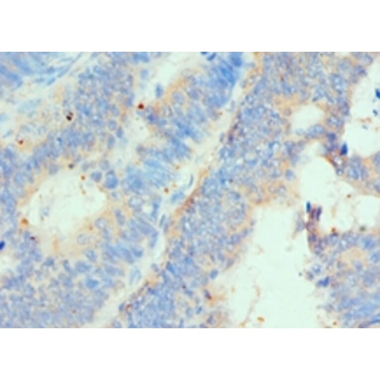 Immunohistochemistry - HIP1 Polyclonal Antibody from Signalway Antibody (42205) - Antibodies.com