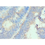 Immunohistochemistry - HIP1 Polyclonal Antibody from Signalway Antibody (42205) - Antibodies.com