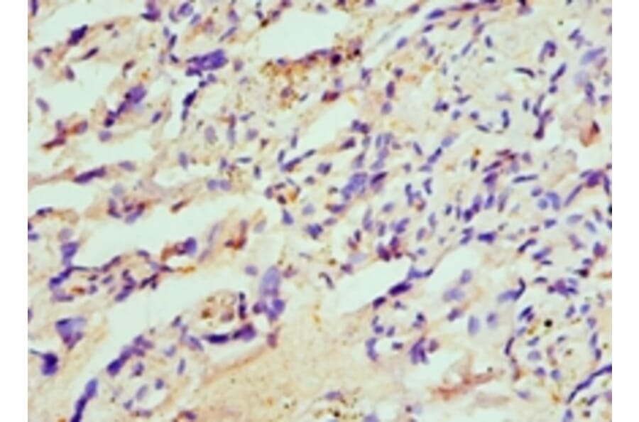 Immunohistochemistry - HIP1 Polyclonal Antibody from Signalway Antibody (42205) - Antibodies.com
