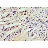 Immunohistochemistry - HIP1 Polyclonal Antibody from Signalway Antibody (42205) - Antibodies.com