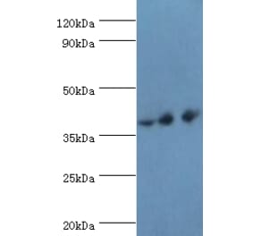 PAX4 Polyclonal Antibody from Signalway Antibody (42287) - Antibodies.com