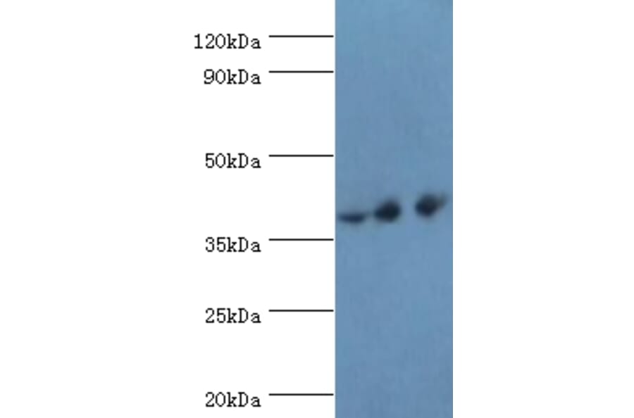PAX4 Polyclonal Antibody from Signalway Antibody (42287) - Antibodies.com