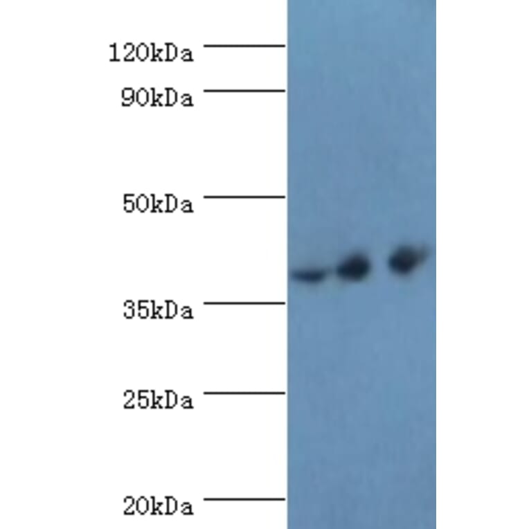 PAX4 Polyclonal Antibody from Signalway Antibody (42287) - Antibodies.com