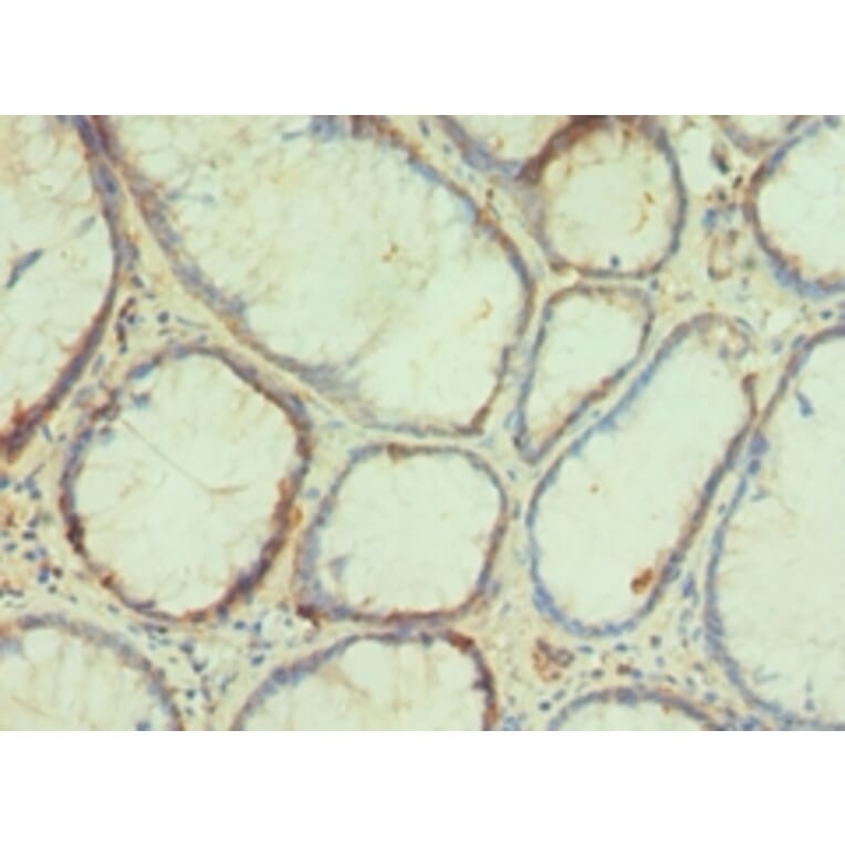 Immunohistochemistry - PAX4 Polyclonal Antibody from Signalway Antibody (42287) - Antibodies.com