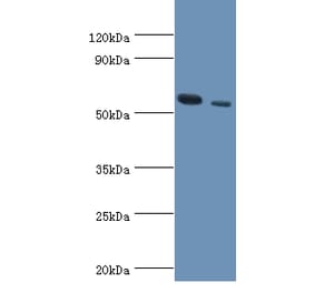 RNF8 Polyclonal Antibody from Signalway Antibody (42309) - Antibodies.com