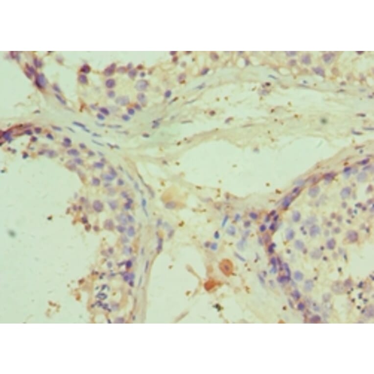 Immunohistochemistry - RNF8 Polyclonal Antibody from Signalway Antibody (42309) - Antibodies.com