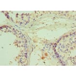 Immunohistochemistry - RNF8 Polyclonal Antibody from Signalway Antibody (42309) - Antibodies.com