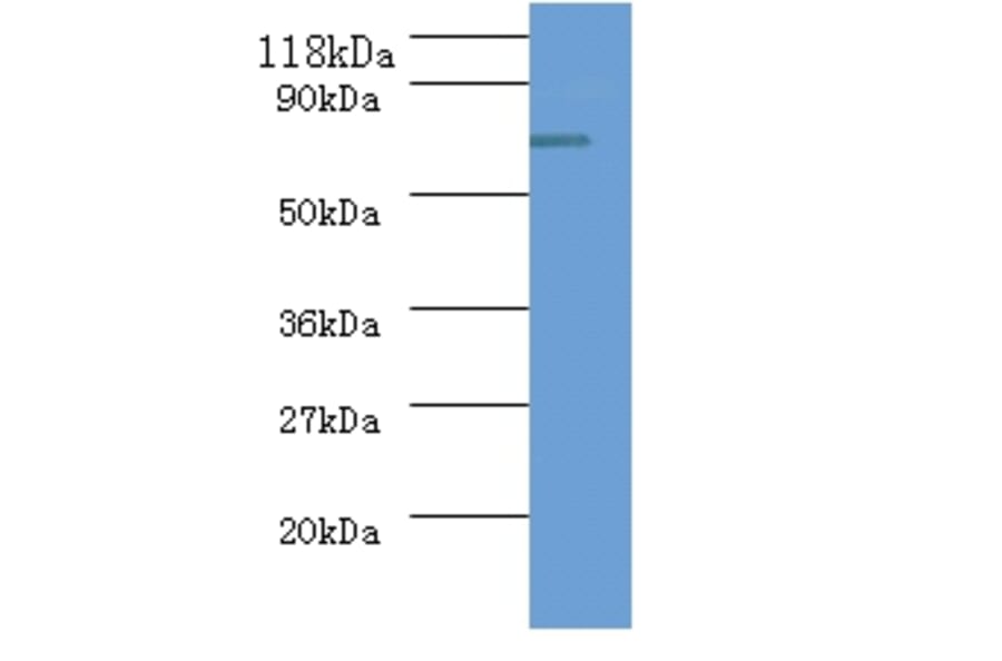 ureB Polyclonal Antibody from Signalway Antibody (42581) - Antibodies.com