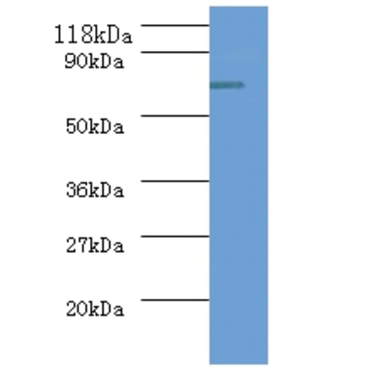 ureB Polyclonal Antibody from Signalway Antibody (42581) - Antibodies.com