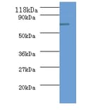 ureB Polyclonal Antibody from Signalway Antibody (42581) - Antibodies.com