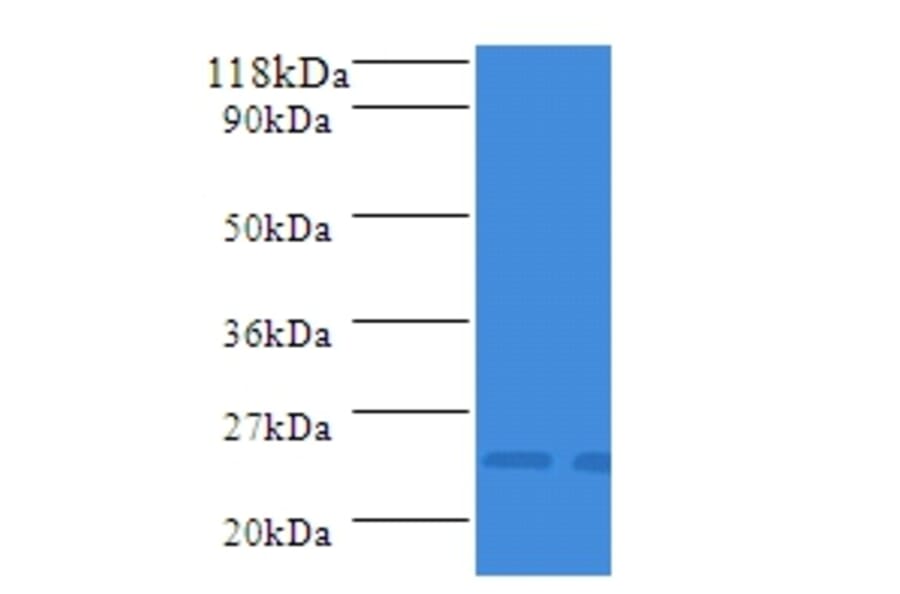 APX2 Polyclonal Antibody from Signalway Antibody (42583) - Antibodies.com