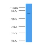 nrdD Polyclonal Antibody from Signalway Antibody (42600) - Antibodies.com