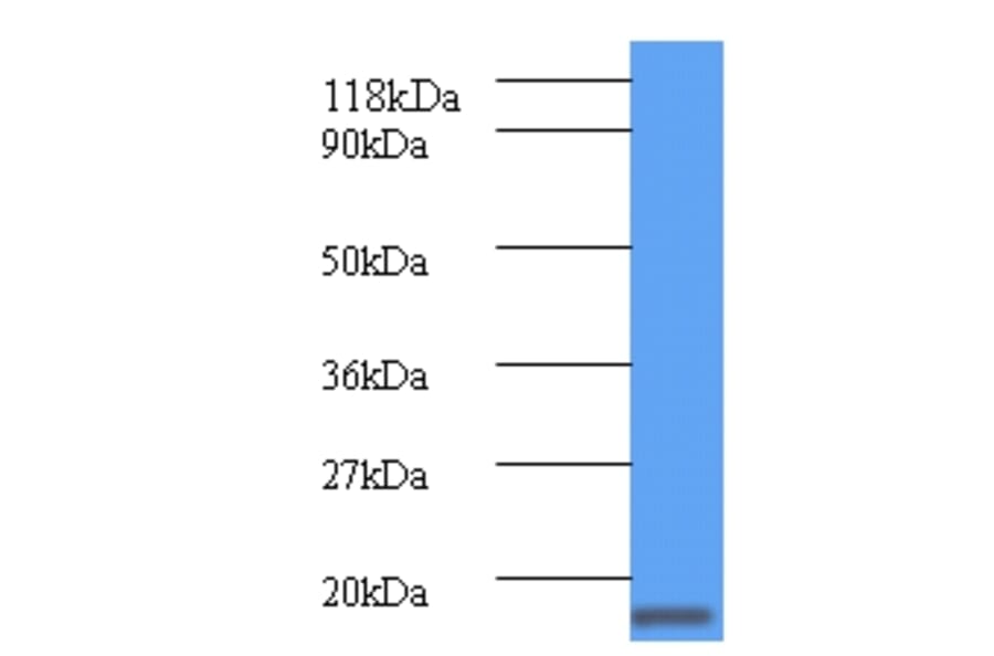 ClpS Polyclonal Antibody from Signalway Antibody (42605) - Antibodies.com