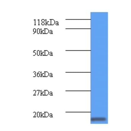 ClpS Polyclonal Antibody from Signalway Antibody (42605) - Antibodies.com