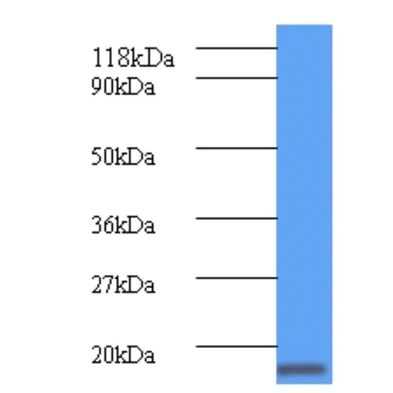 ClpS Polyclonal Antibody from Signalway Antibody (42605) - Antibodies.com