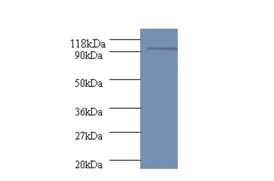 polA Polyclonal Antibody from Signalway Antibody (42606) - Antibodies.com