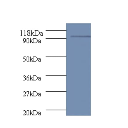 polA Polyclonal Antibody from Signalway Antibody (42606) - Antibodies.com