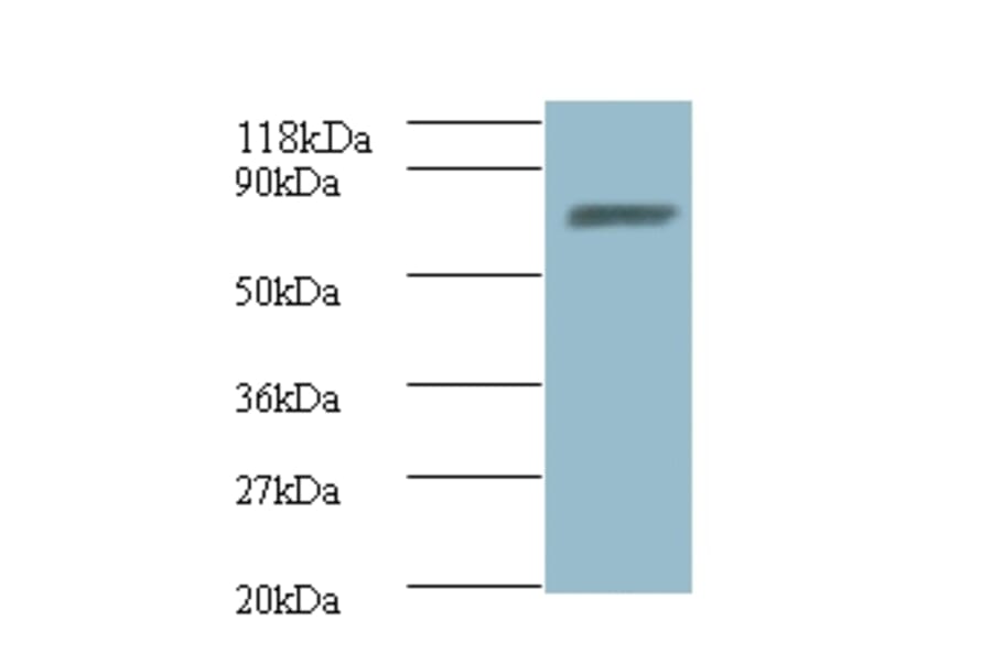 ligA Polyclonal Antibody from Signalway Antibody (42630) - Antibodies.com