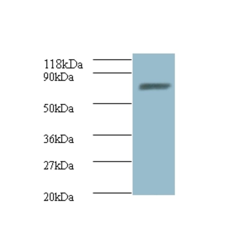 ligA Polyclonal Antibody from Signalway Antibody (42630) - Antibodies.com