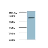 ligA Polyclonal Antibody from Signalway Antibody (42630) - Antibodies.com
