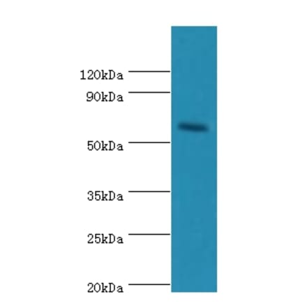 CRY2 Polyclonal Antibody from Signalway Antibody (42656) - Antibodies.com