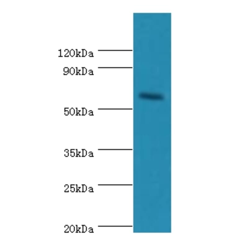 CRY2 Polyclonal Antibody from Signalway Antibody (42656) - Antibodies.com