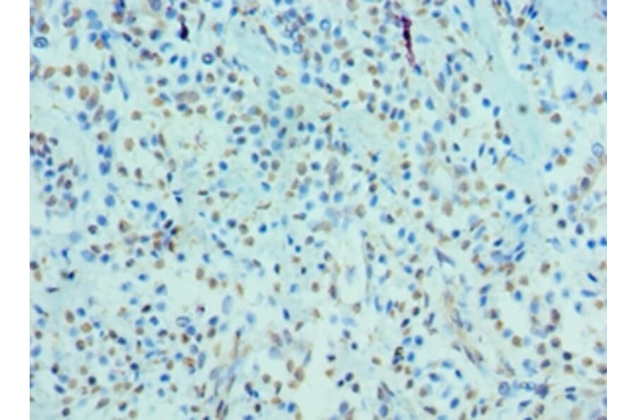 Immunohistochemistry - CRY2 Polyclonal Antibody from Signalway Antibody (42656) - Antibodies.com