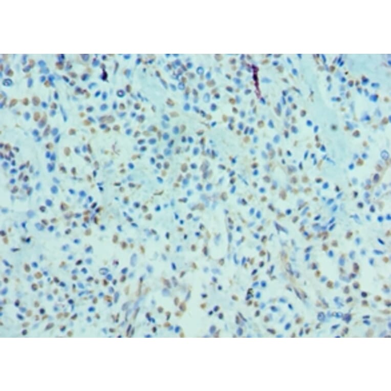 Immunohistochemistry - CRY2 Polyclonal Antibody from Signalway Antibody (42656) - Antibodies.com
